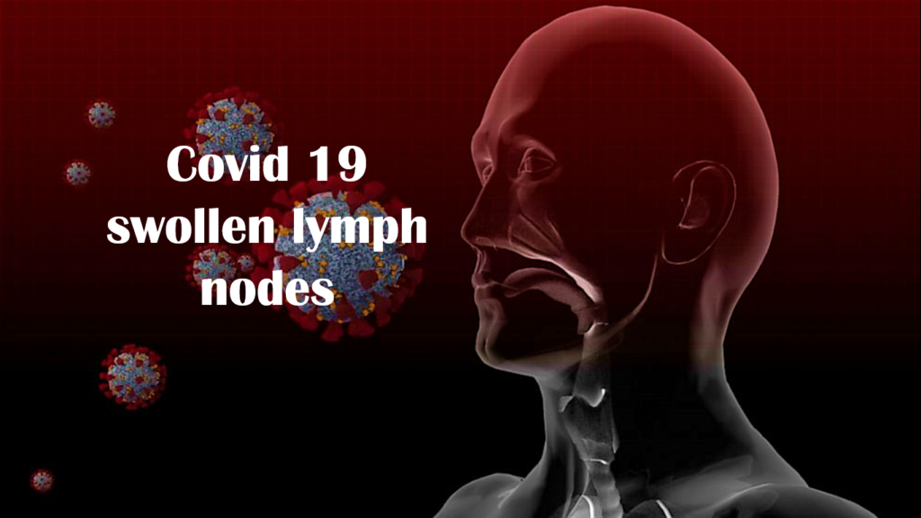 swollen lymph nodes covid