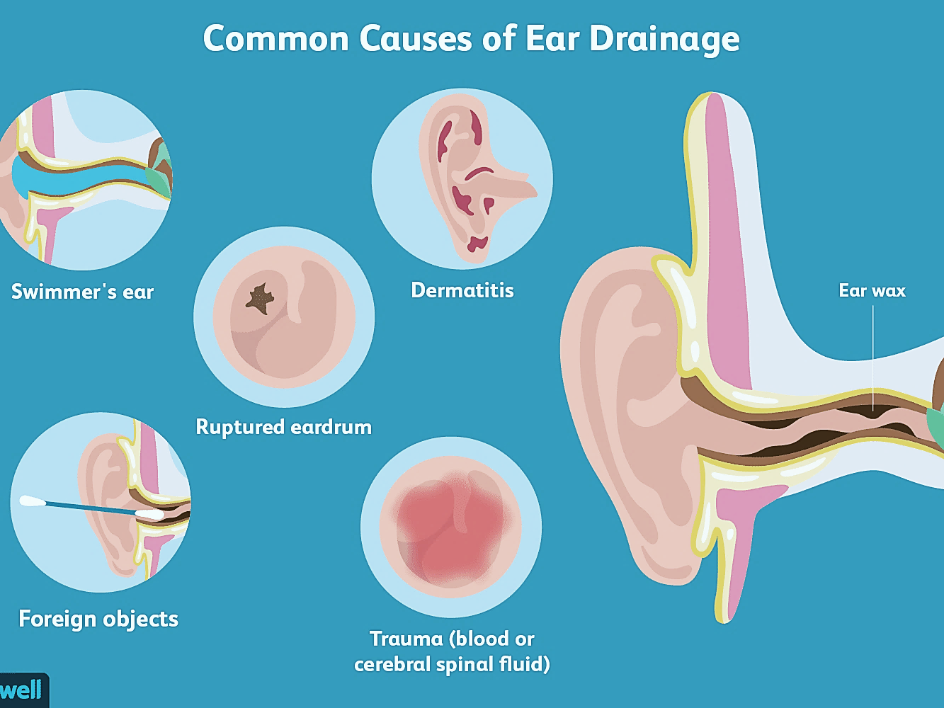 Ear pain covid 